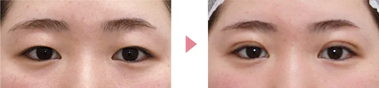 二重写真