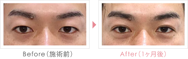 症例写真